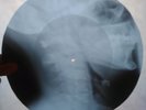 Jimi Hendrix - Voodoo Child - X-RAY USSR ROENTGEN BONES RECORD - Skull