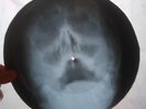The Zombies - She’s Not There X-RAY - USSR ROENTGEN BONES RECORD - SKULL