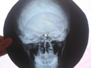 ROLLING STONES - DEVIL - USSR X-RAY ROENTGEN BONES RECORD