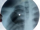 JIMI HENDRIX - SGT. PEPPERS - BEATLES COVER - GEORGIAN USSR X-RAY ROENTGEN BONES