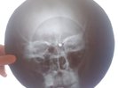 Chuck Berry - Rock and Roll Music  X-RAY USSR ROENTGEN Bones RECORD