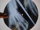 Meat City - John Lennon  X-RAY USSR ROENTGEN BONES RECORD