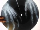 The Doors - Hello, I Love You  X-RAY USSR ROENTGEN BONES RECORD