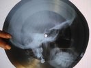 T.REX - SHOCK ROCK X-RAY USSR ROENTGEN BONES RECORD 1973