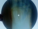 CHUBBY CHECKER - THE FLY - GEORGIAN USSR X-RAY ROENTGEN FOOT BONES RECORD