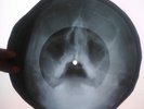 Roy Orbison - Only the Lonely  X-RAY USSR ROENTGEN BONES