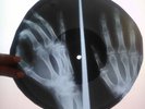 The Temptations - My Girl  X-RAY USSR ROENTGEN BONES