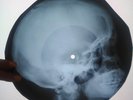 Jimi Hendrix - Purple Haze  X-RAY USSR ROENTGEN BONES