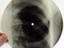 X-Ray 78rpm VERTINSKY Days go by USSR AUDIO ROENTGEN BONES RECORD Ribs 1950s