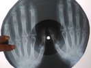 The Doors - Love Me Two Times X-RAY USSR ROENTGEN Bones Record