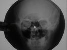 Elvis Presley Love Me Tender  X-RAY USSR ROENTGEN Bones Record Skull