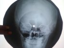 X-RAY The Monkees - Daydream Believer UNIQUE USSR ROENTGEN BONES