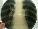 X-Ray 78rpm VERTINSKY In our room USSR AUDIO ROENTGEN BONES Thorax Ribs 1950s
