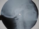 Beatles - Come Together UNIQUE X-RAY USSR ROENTGEN Bones Record