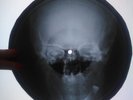 Who  My Generation UNIQUE X-RAY USSR ROENTGEN Bones Record