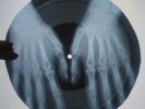 Beach Boys In My Room  X-RAY 78 USSR ROENTGEN Bones Record