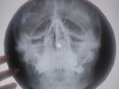Chuck Berry - Maybelline  X-RAY USSR ROENTGEN BONES