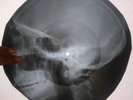 The Beatles  A Hard Day’s Night UNIQUE X-RAY USSR ROENTGEN Bones Record Skull