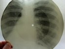 X-Ray 78rpm VERTINSKY sings 