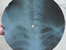 BEATLES - PENNY LANE - UNIQUE USSR GEORGIAN X-RAY ROENTGEN RIBS BONES RECORD