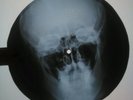 Beatles - Something X-RAY USSR ROENTGEN Bones Record Skull