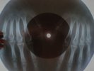 Who - See Me, Feel Me  X-RAY USSR ROENTGEN Bones Record