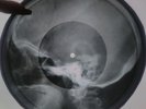 Velvet Underground - Sunday Morning X-RAY USSR ROENTGEN Bones Record SKULL