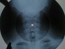Beatles - Yesterday X-RAY USSR ROENTGEN Bones Record