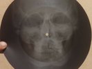 ROLLING STONES - BETTER MOVE ON - UNIQUE USSR X-RAY ROENTGEN CRAZY SKULL RECORD