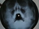 Zombies - Time of the Season X-RAY USSR ROENTGEN Bones Record Skull
