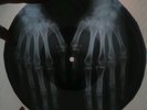 Beatles - Penny Lane X-RAY USSR ROENTGEN Bones Record
