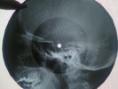 The Monkees - I'm a Believer  X-RAY USSR ROENTGEN Bones Record Skull