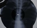 David Bowie - Rebel Rebel X-RAY USSR ROENTGEN Bones Record