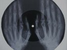 Elvis Presley - In the ghetto  X-RAY USSR ROENTGEN Bones Record