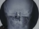 BEATLES - Back in the U.S.S.R. X-RAY USSR ROENTGEN Bones Record Skull