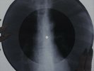 Beatles - Because X-RAY USSR ROENTGEN Bones Record