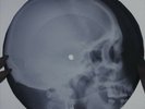 Velvet Underground - After Hours X-RAY USSR ROENTGEN Bones Record Skull