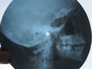 CHUCK BERRY - YOU NEVER CAN TELL - USSR GEORGIAN X-RAY ROENTGEN SKULL RECORD