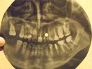 ANIMALS -HOUSE OF THE RISING SUN -USSR GEORGIA X-RAY ROENTGEN SKULL TEETH RECORD