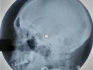 Nina Simone - My Baby Just Cares For Me X-RAY USSR ROENTGEN Bones Record Skull
