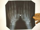 X Ray USSR Vinyl Record Music on Bones Roentgen Bob Dylan Like a Rolling Stone