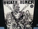 Broken Bones 