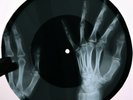 Beatles - Help  X-RAY USSR ROENTGEN Bones Record