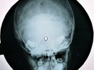Ronettes - Be My Baby X-RAY USSR ROENTGEN Bones Record Skull