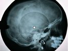 Marilyn Monroe - I Wanna Be Loved by You X-RAY USSR ROENTGEN Bones Record Skull