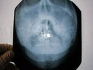 Beatles in A Day Life X Ray USSR Vinyl Record Music on Bones Roentgen