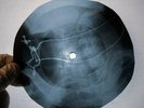X Ray USSR Vinyl Record Music on Bones Roentgen Beatles Strawberry Fields Foreve