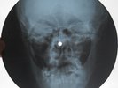 JANIS JOPLIN - PIECE OF MY HEART - USSR GEORGIAN X-RAY ROENTGEN SKULL RECORD