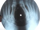 STOOGES - I WANNA BE YOUR DOG - UNIQUE USSR GEORGIAN X-RAY ROENTGEN BONES RECORD