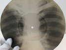 X-Ray Audio roentgen film Record Bones Ribs 50s Lestchenko Tango Come Back